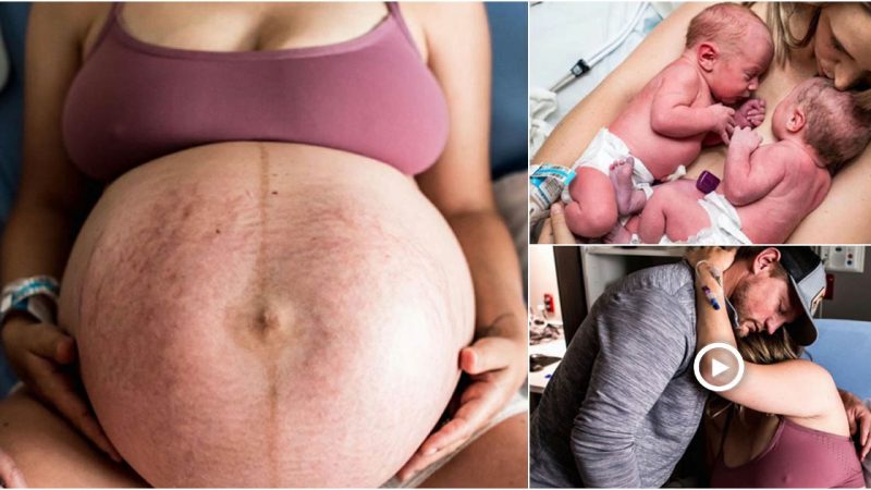 beautiful photos document the unique moments of the twins’ birth.