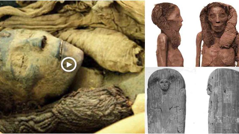 Lady Rai: The Oldest Known Mummy With Evidence Of Atherosclerosisf