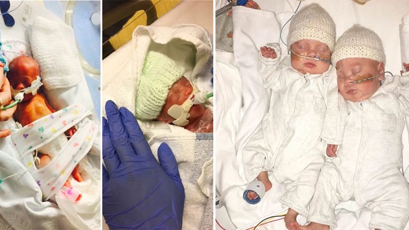 Our Little Warriors: The Story of Twins Born at 24 Weeks and So Tiny They Fit in Their Mother’s Hands.