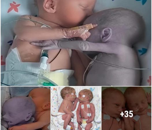 Heartwarming Video: Mother Places Newborn Boy Beside Twin Sister Battling for Life