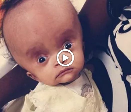 Unraveling the Enigma: The Intriguing Phenomenon of a Baby’s Remarkably Large Head