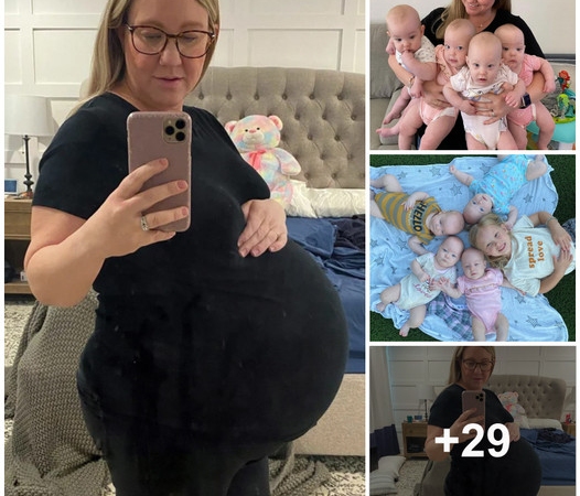 A Journey of Surprises: Mother of Quadruplets Shares Heartwarming Before-and-After Baby Photos