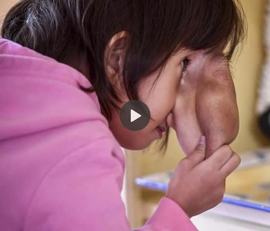 From Outcast to Unbreakable Bond: A Daughter’s Incredible Journey with an Exceptional Nose