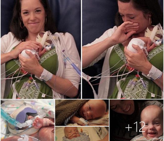 A Remarkable Journey: Premature Baby’s Miraculous First Year Touches Hearts Worldwide