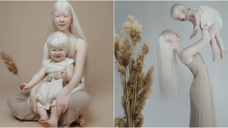 Radiant Angels: The Captivating Beauty of Albinism Embodied in Two Sisters